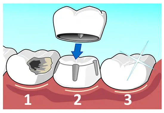 relaxed dental patient receiving treatment