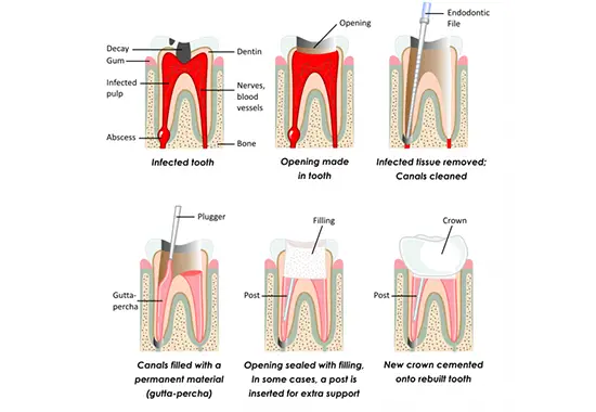 relaxed dental patient receiving treatment