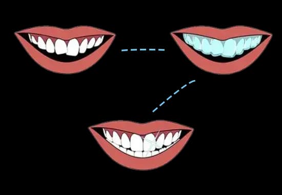 Patient nervously waiting to visit the dentist.