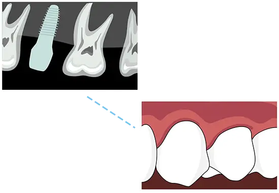 Patient nervously waiting to visit the dentist.